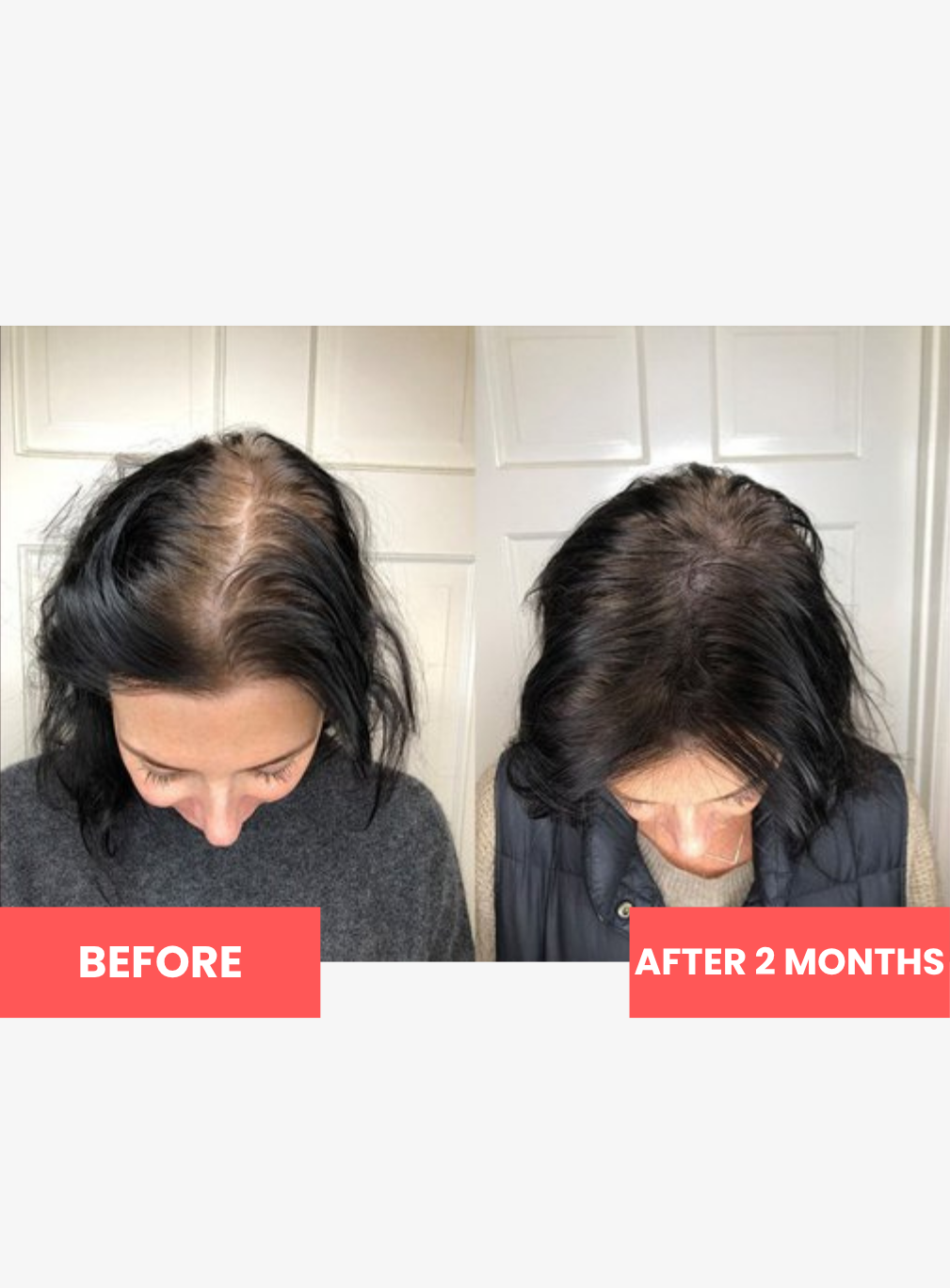 Complete Hair Reset Gummies