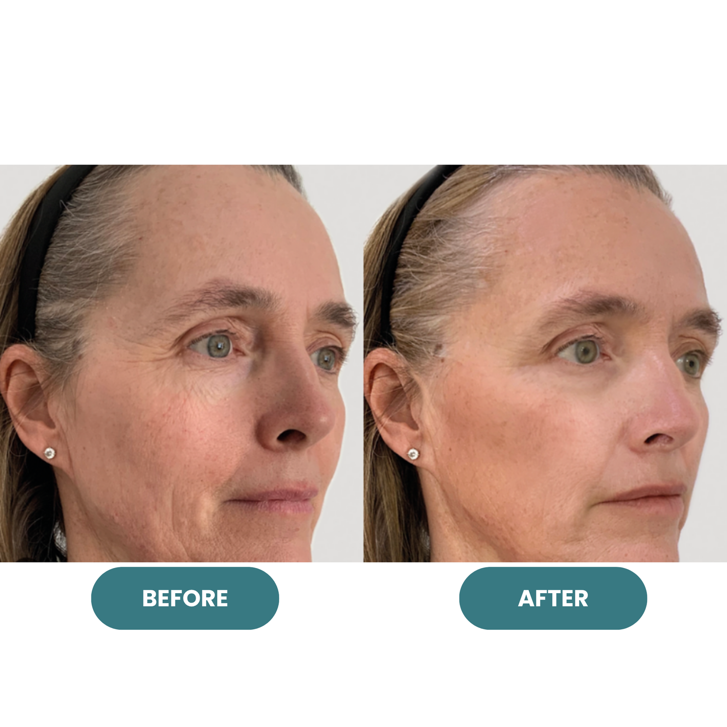 Crepey Skin Repair Cream