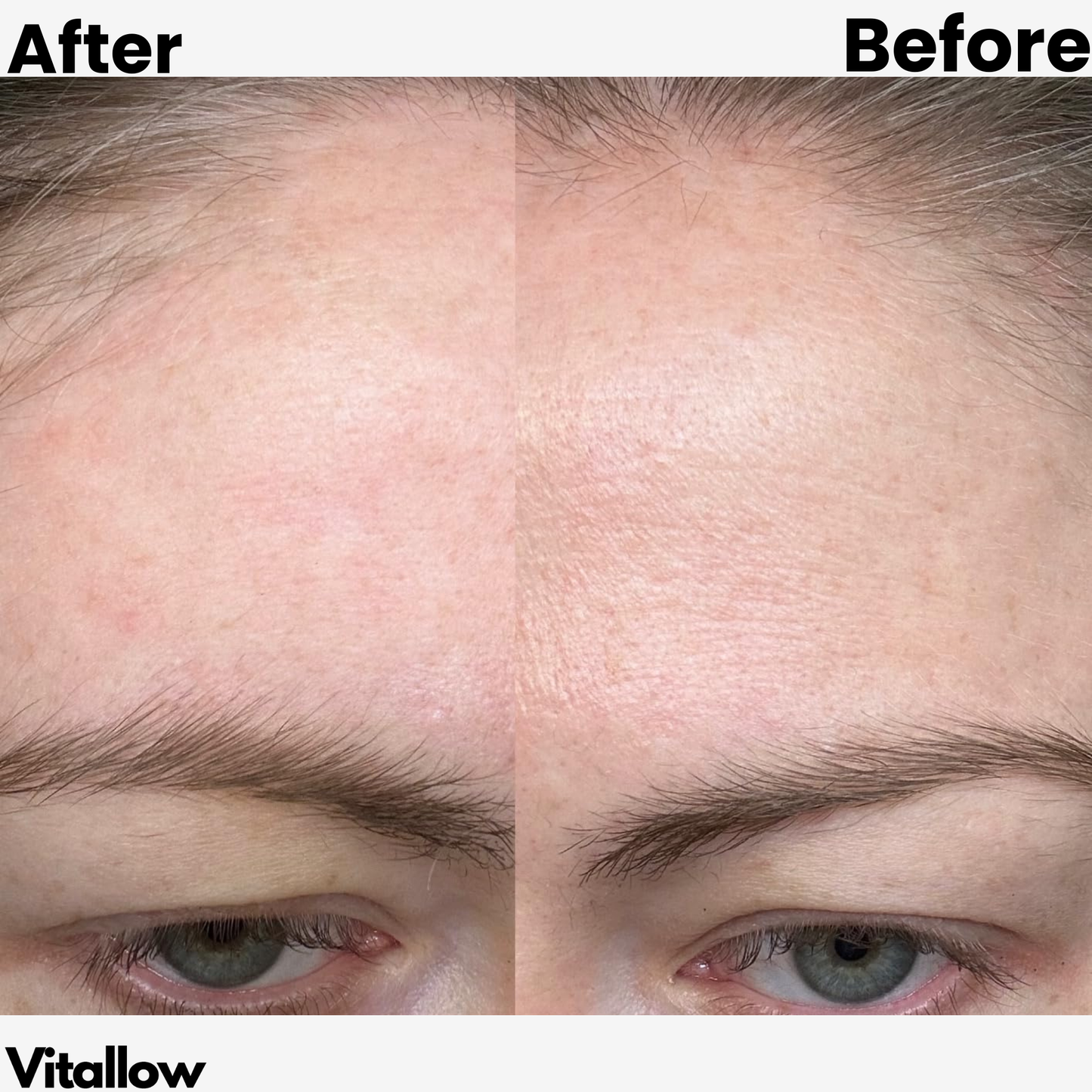 OVERNIGHT CREPEY SKIN REPAIR CREAM